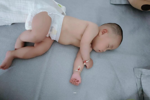 简阳宝宝脸上有白色斑块